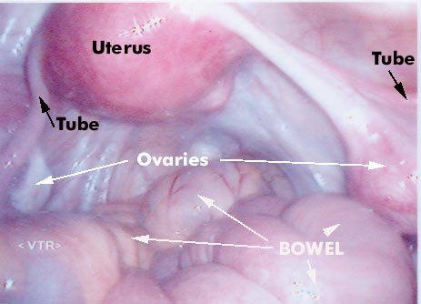 normal female organs